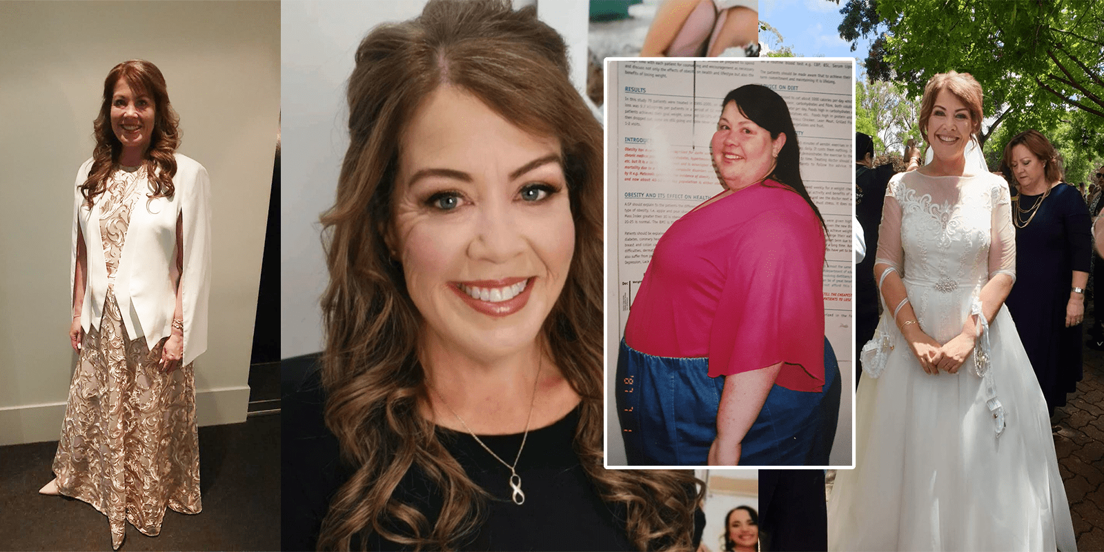 Photos of Laurels's weight loss journey 